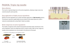 Uniever (Formerly Paskin) Ultra-Fine Atraumatic Micro Needles